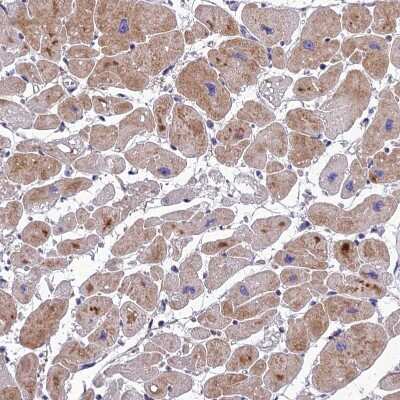 Immunohistochemistry-Paraffin: AdipoR2 Antibody [NBP1-91652]