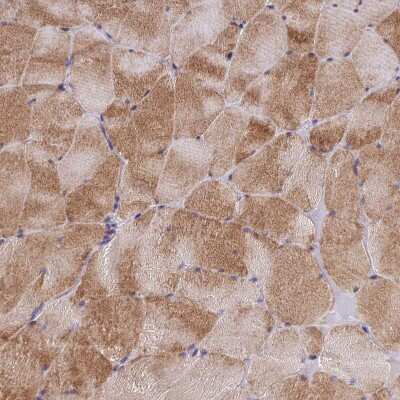 Immunohistochemistry-Paraffin: AdipoR2 Antibody [NBP1-91652]