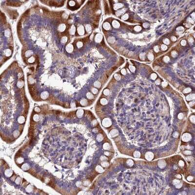 Immunohistochemistry-Paraffin: AdipoR2 Antibody [NBP1-91652]