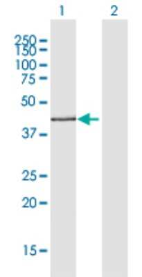 Western Blot: AdipoR2 Antibody [H00079602-D01P]