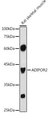 Western Blot: AdipoR2 AntibodyAzide and BSA Free [NBP2-92087]