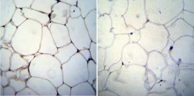 Immunohistochemistry: Adiponectin/Acrp30 Antibody (19F1) [NBP2-22450]