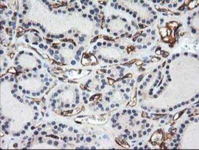 Immunohistochemistry-Paraffin: Adiponectin/Acrp30 Antibody (OTI1H1) [NBP2-01418]
