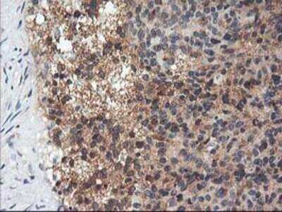 Immunohistochemistry-Paraffin: Adiponectin/Acrp30 Antibody (OTI1H1) [NBP2-01418]