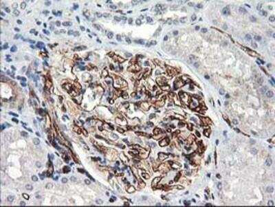 Immunohistochemistry-Paraffin: Adiponectin/Acrp30 Antibody (OTI1H1) [NBP2-01418]