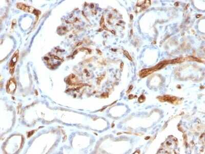 Immunohistochemistry-Paraffin: Adiponectin/Acrp30 Antibody (ADPN/1370) - Azide and BSA Free [NBP2-54319]