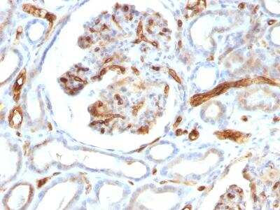 Immunohistochemistry-Paraffin: Adiponectin/Acrp30 Antibody (ADPN/1370) [NBP2-47652]