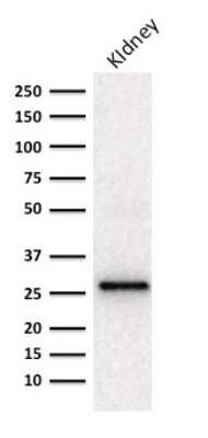 Western Blot: Adiponectin/Acrp30 Antibody (ADPN/1370) [NBP2-47652]