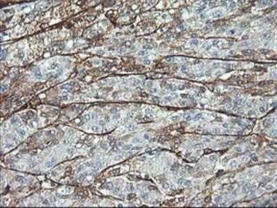 Immunohistochemistry: Adiponectin/Acrp30 Antibody (OTI1H1) - Azide and BSA Free [NBP2-71422]