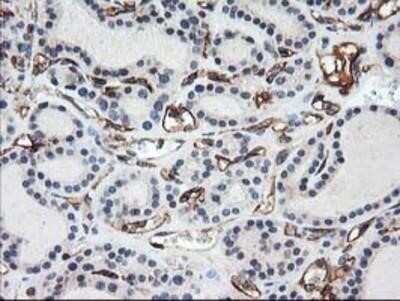 Immunohistochemistry: Adiponectin/Acrp30 Antibody (OTI1H1) - Azide and BSA Free [NBP2-71422]