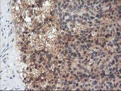 Immunohistochemistry: Adiponectin/Acrp30 Antibody (OTI1H1) - Azide and BSA Free [NBP2-71422]