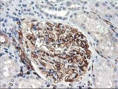 Immunohistochemistry: Adiponectin/Acrp30 Antibody (OTI1H1) - Azide and BSA Free [NBP2-71422]