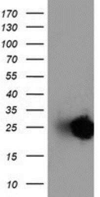 Western Blot: Adiponectin/Acrp30 Antibody (OTI1H1)Azide and BSA Free [NBP2-71422]