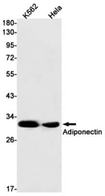 Western Blot: Adiponectin/Acrp30 Antibody (S03-9F3) [NBP3-20028]