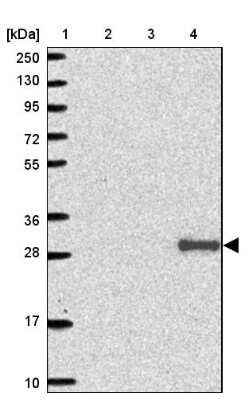 Western Blot: Adiponectin/Acrp30 Antibody [NBP2-38657]