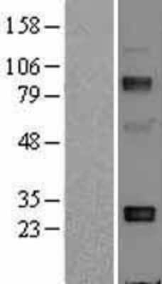 Western Blot: Adiponectin/Acrp30 Overexpression Lysate [NBL1-07342]