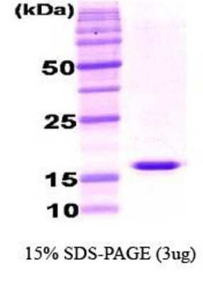 SDS-PAGE: Recombinant Mouse Adiponectin/Acrp30 Protein [NBC1-18447]