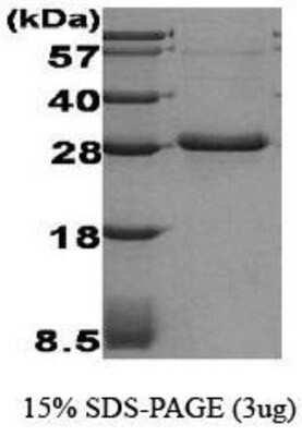 SDS-PAGE: Recombinant Human Adiponectin/Acrp30 Protein [NBC1-18461]