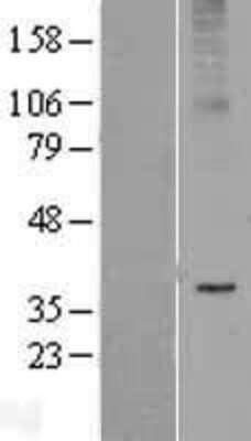 Western Blot: AdipoR2 Overexpression Lysate [NBL1-07344]