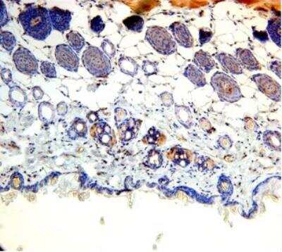 Immunohistochemistry: Adiponutrin/PNPLA3 Antibody [NBP1-30092]