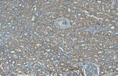 Immunohistochemistry-Paraffin: Adiponutrin/PNPLA3 Antibody [NBP1-00227]