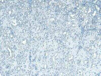 Immunohistochemistry-Paraffin: Adiponutrin/PNPLA3 Antibody [NBP1-00227]