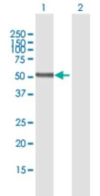 Western Blot: Adiponutrin/PNPLA3 Antibody [H00080339-B01P]