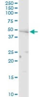 Western Blot: Adiponutrin/PNPLA3 Antibody [H00080339-D01P]