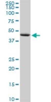 Western Blot: Adiponutrin/PNPLA3 Antibody [H00080339-D01P]