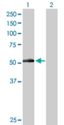 Western Blot: Adiponutrin/PNPLA3 Antibody [H00080339-D01P]