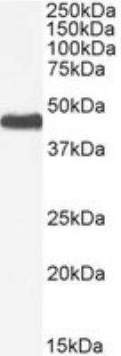 Western Blot: Adiponutrin/PNPLA3 Antibody [NBP1-00227]