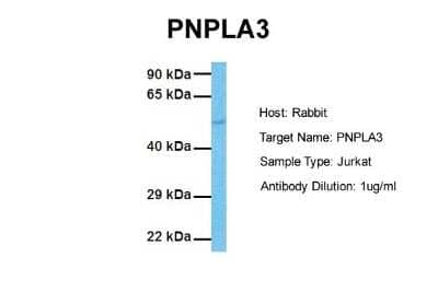 Western Blot: Adiponutrin/PNPLA3 Antibody [NBP1-54611]