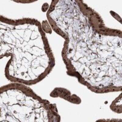 Immunohistochemistry-Paraffin: Adrenomedullin/ADM Antibody [NBP3-17681]