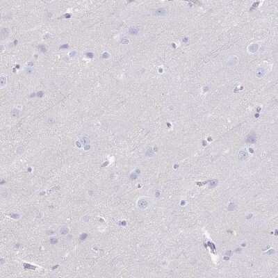 Immunohistochemistry-Paraffin: Adrenomedullin R/ADMR/GPR182 Antibody [NBP1-90231]