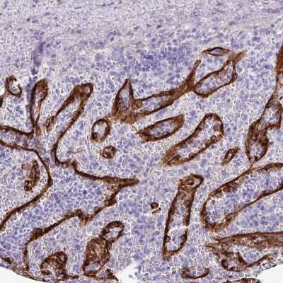 Immunohistochemistry-Paraffin: Adrenomedullin R/ADMR/GPR182 Antibody [NBP1-90231]