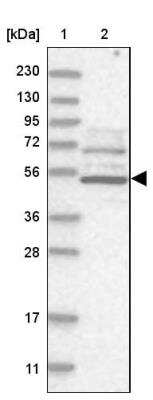 Western Blot: Adrenomedullin R/ADMR/GPR182 Antibody [NBP1-90231]