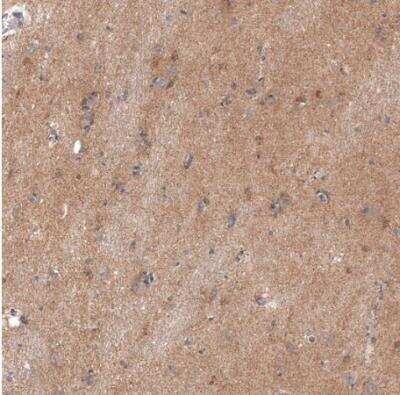 Immunohistochemistry-Paraffin: Adropin Antibody [NBP1-88245]