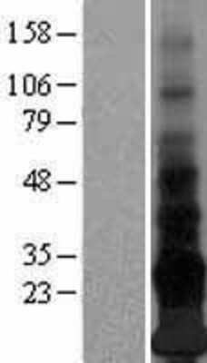 Western Blot: Adropin Overexpression Lysate [NBL1-08588]