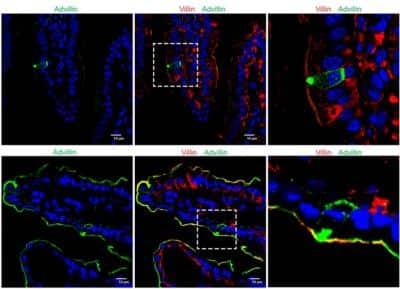 Immunohistochemistry: Advillin Antibody [NBP2-34118]