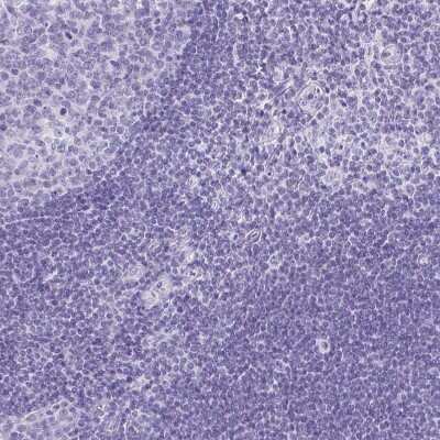 Immunohistochemistry-Paraffin: Advillin Antibody [NBP2-34118]