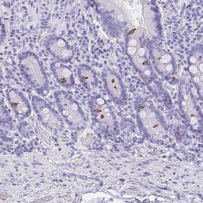 Immunohistochemistry-Paraffin: Advillin Antibody [NBP2-34118]