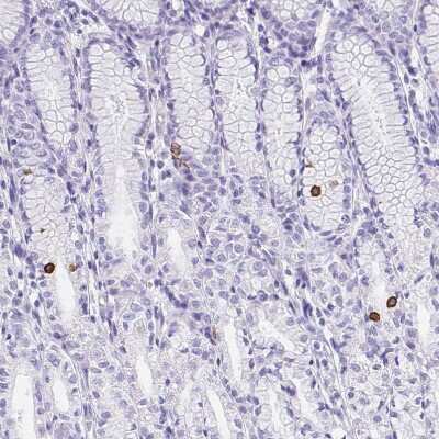 Immunohistochemistry-Paraffin: Advillin Antibody [NBP2-34118]