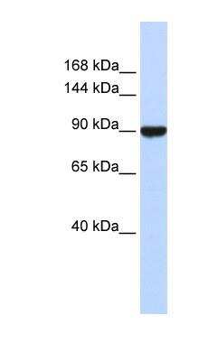 Western Blot: Advillin Antibody [NBP1-80312]