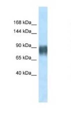 Western Blot: Advillin Antibody [NBP1-91606]