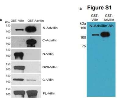 Western Blot: Advillin Antibody [NBP2-34118]