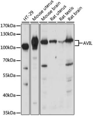 Western Blot: Advillin AntibodyAzide and BSA Free [NBP2-92263]