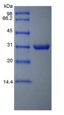 SDS-PAGE: Recombinant Aeromonas Aminopeptidase Protein [NBP2-34873]