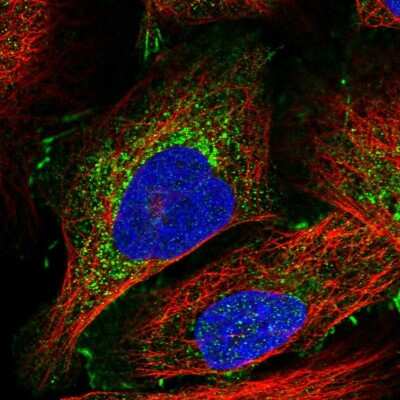 Immunocytochemistry/ Immunofluorescence: Afadin/AF-6 Antibody [NBP1-90220]
