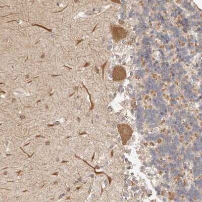 Immunohistochemistry-Paraffin: Afadin/AF-6 Antibody [NBP1-90218]
