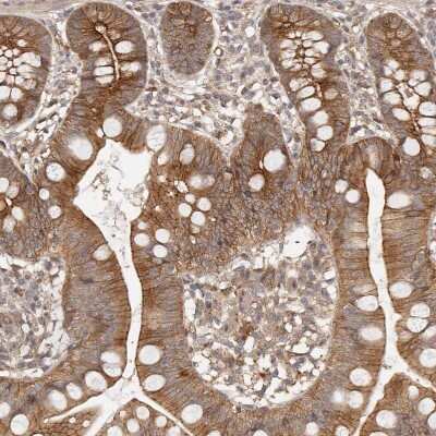 Immunohistochemistry-Paraffin: Afadin/AF-6 Antibody [NBP1-90218]